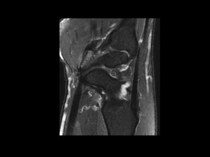 Figure 2 for case trapezium ( RID2193 )
